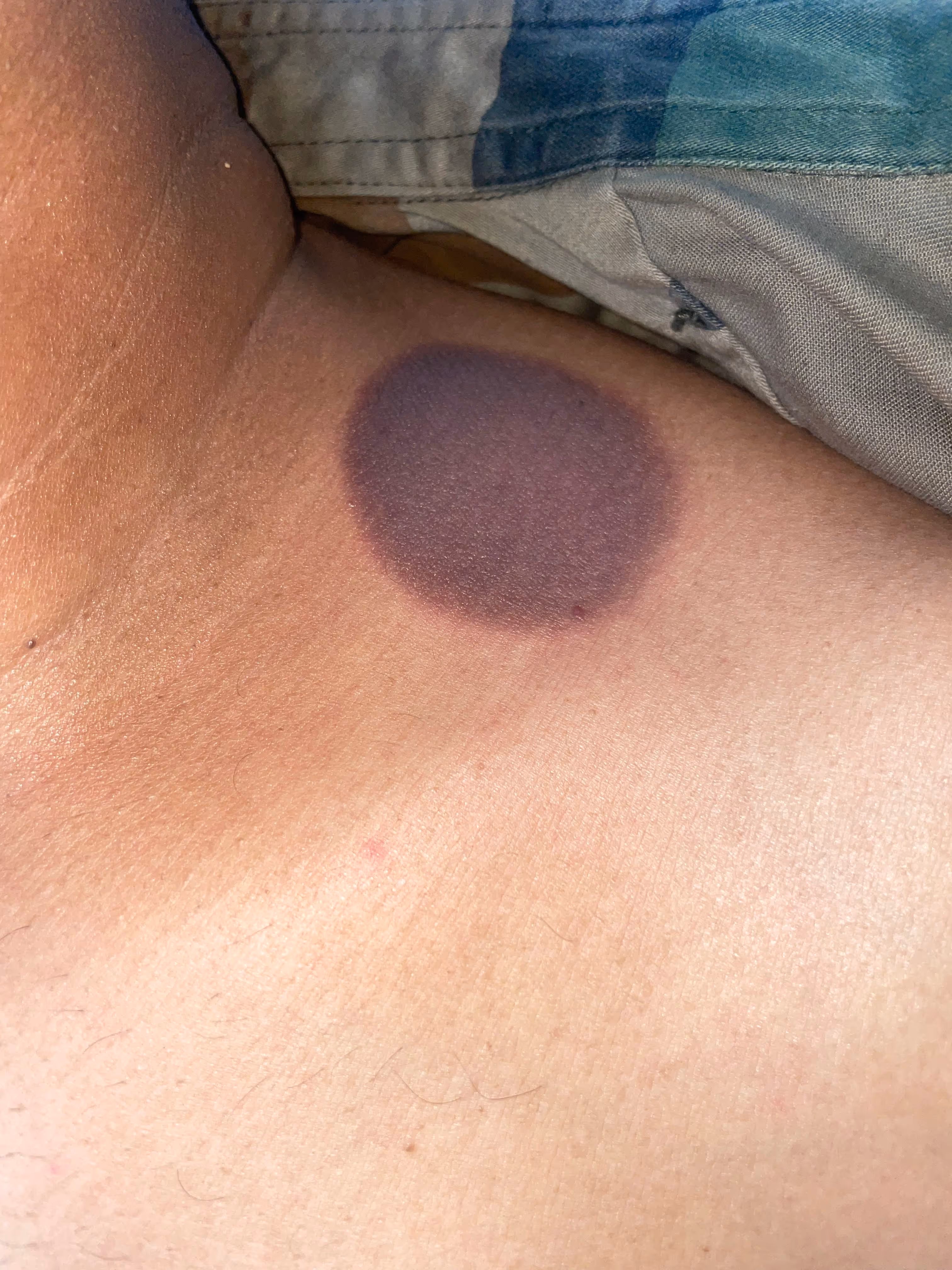 Illustration related to Adverse Drug Reaction