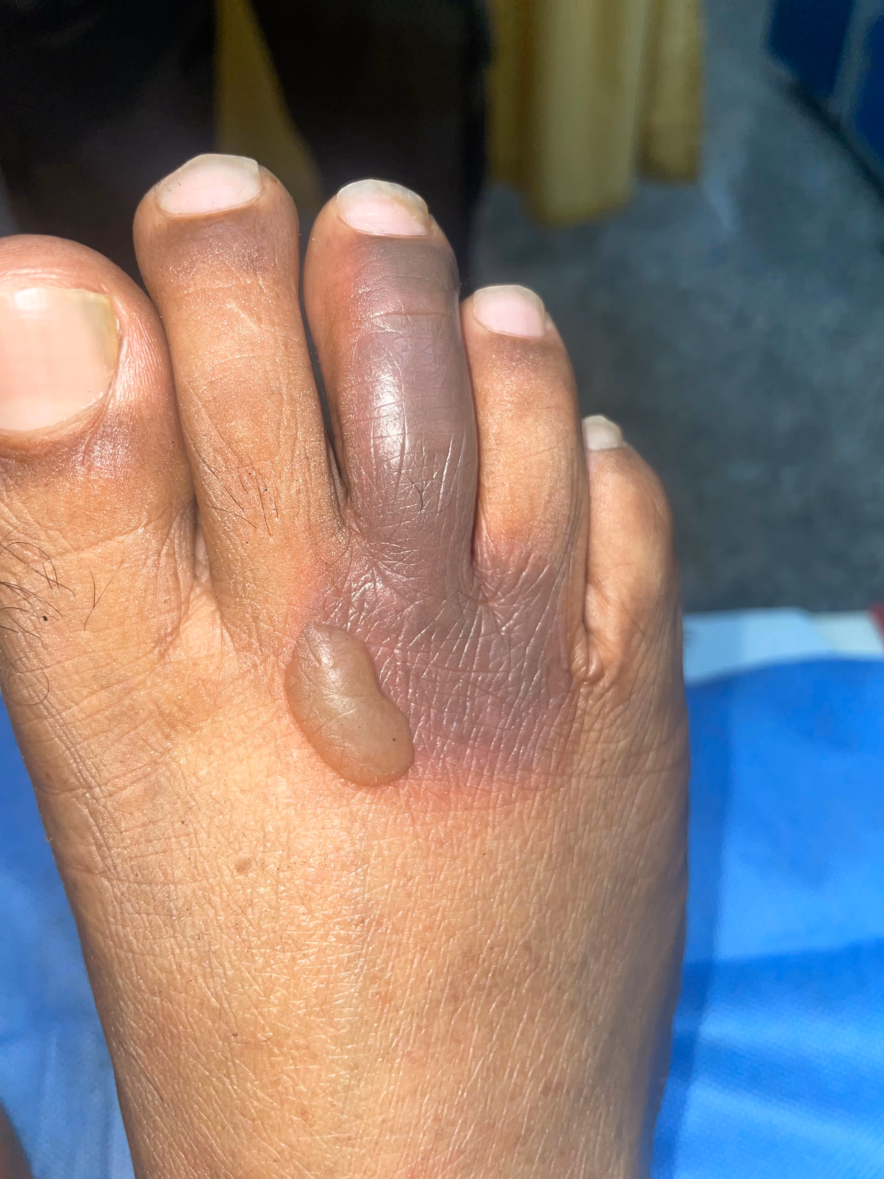 Illustration related to Adverse Drug Reaction